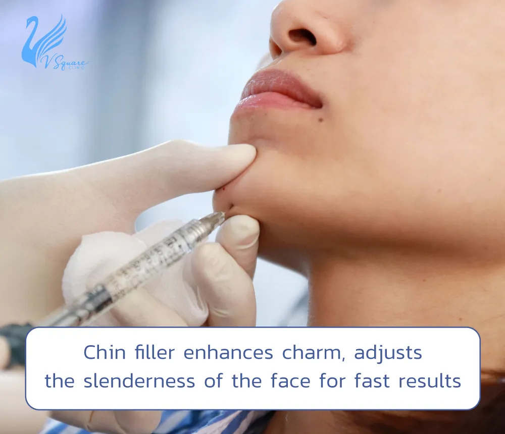 Chin-filler-enhances-charm