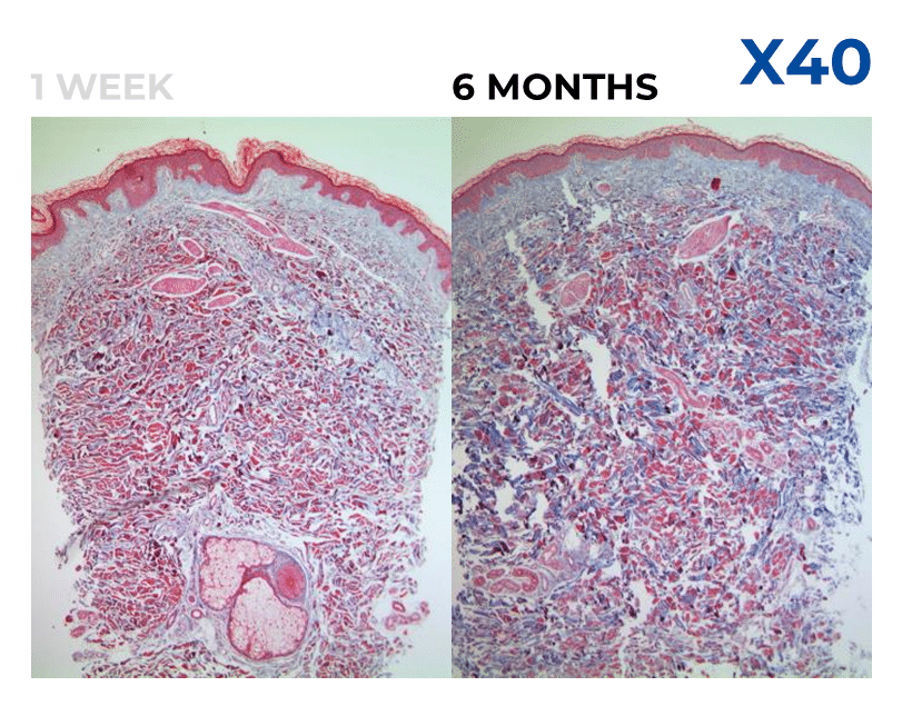 Is Juvelook a Filler? Here's What You Actually Need to Know