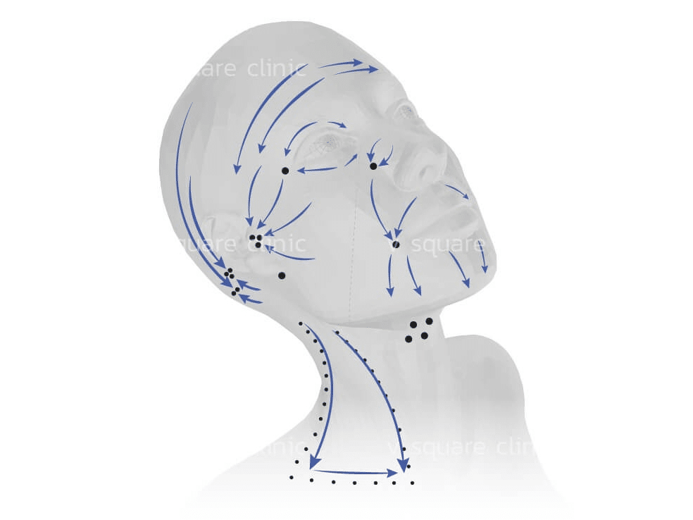 MADE Collagen 16-point injection technique(1)