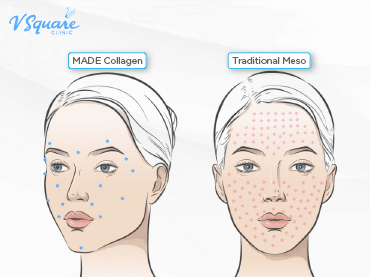 MADE Collagen-370x277