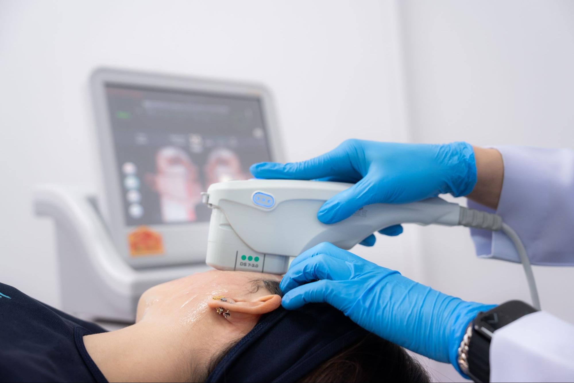 Ulthera treatment process