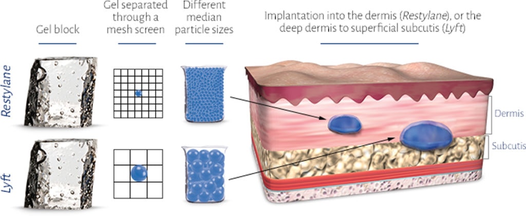 Each filler type suits different skin conditions