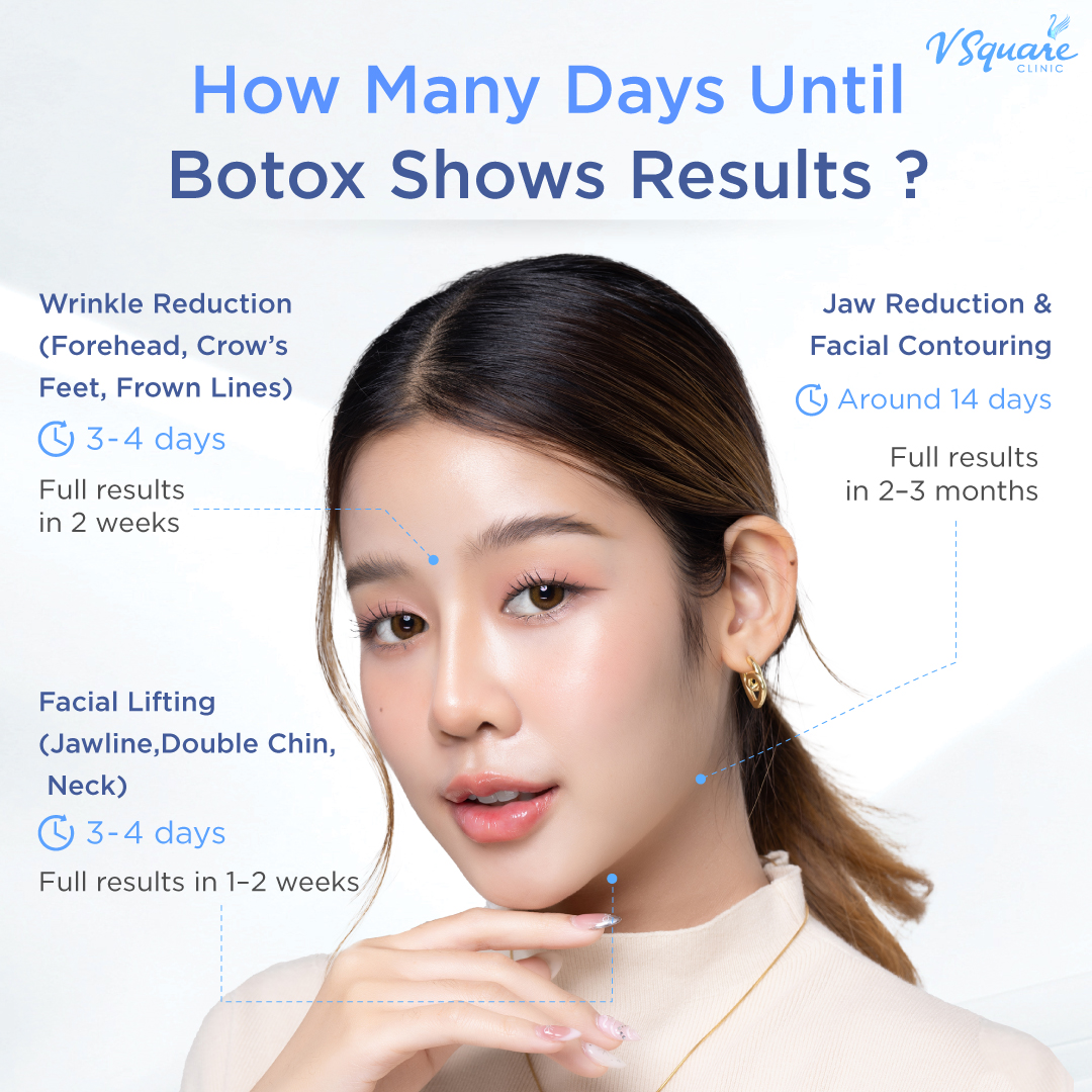 How Long Does It Take for Neuronox Botox to Show Results
