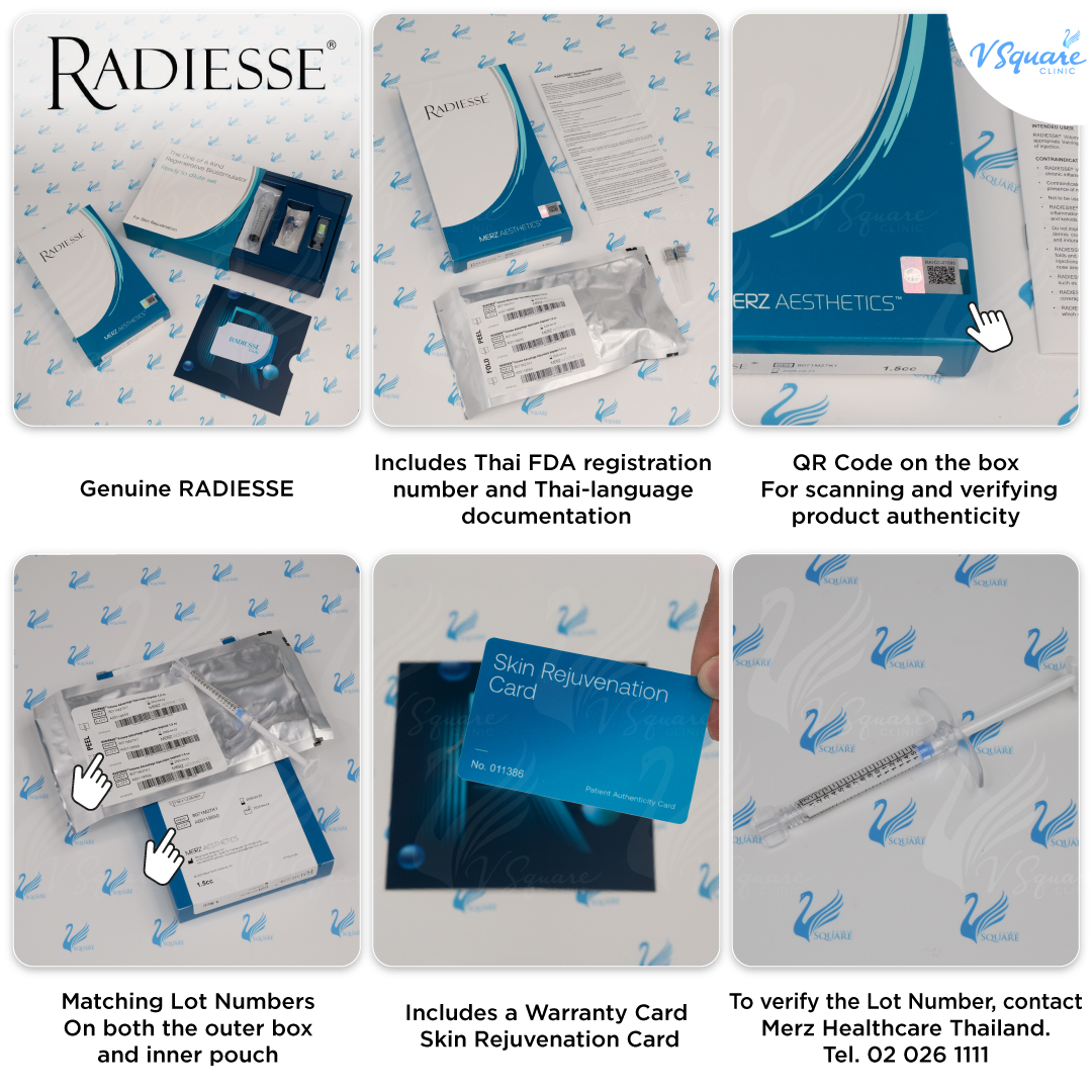 How to Identify Genuine Radiesse