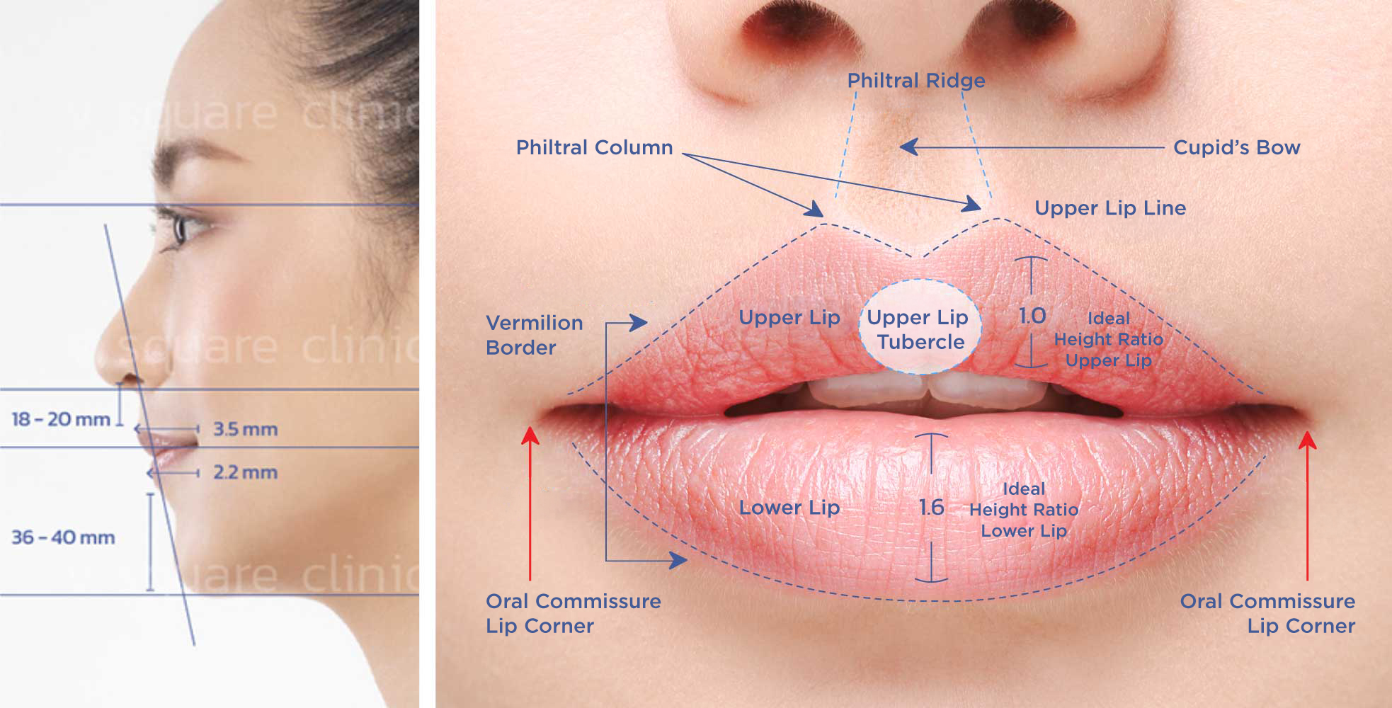 Ideal lip proportions