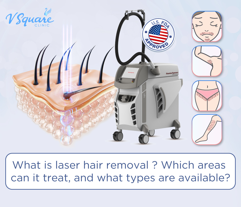 Laser Hair Removal