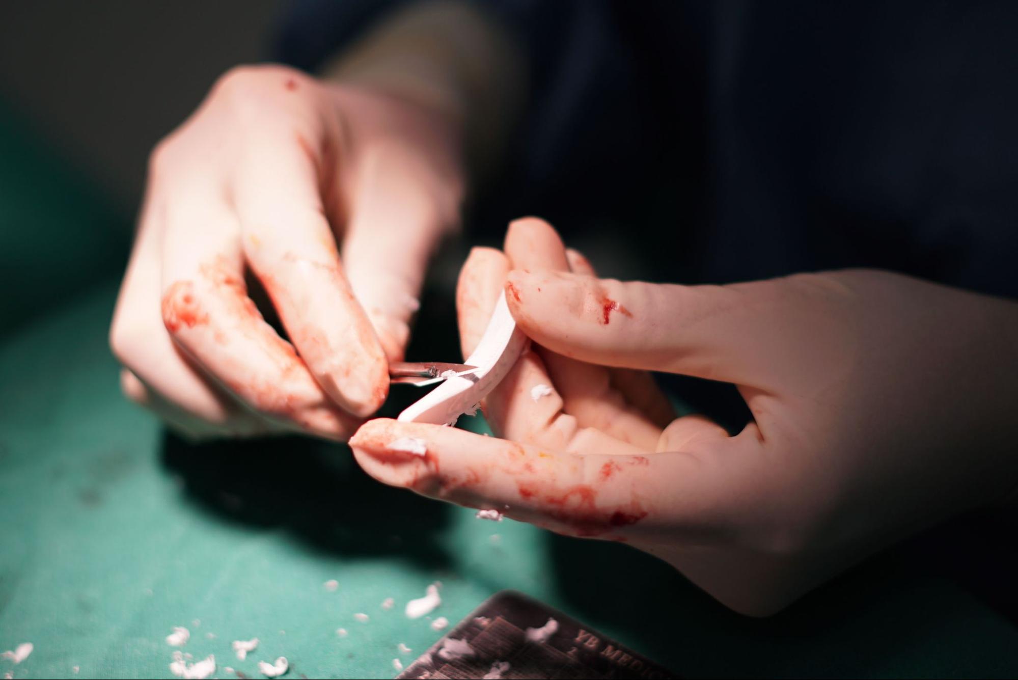 Materials used in rhinoplasty