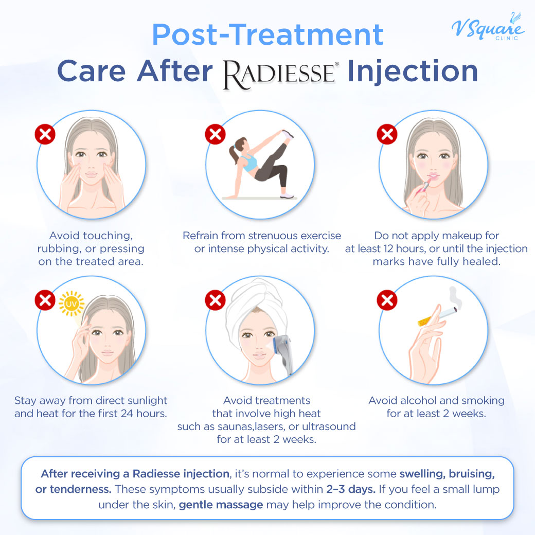 Post-treatment care after Radiesse injection