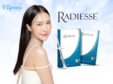 Radiesse Filler 370x277