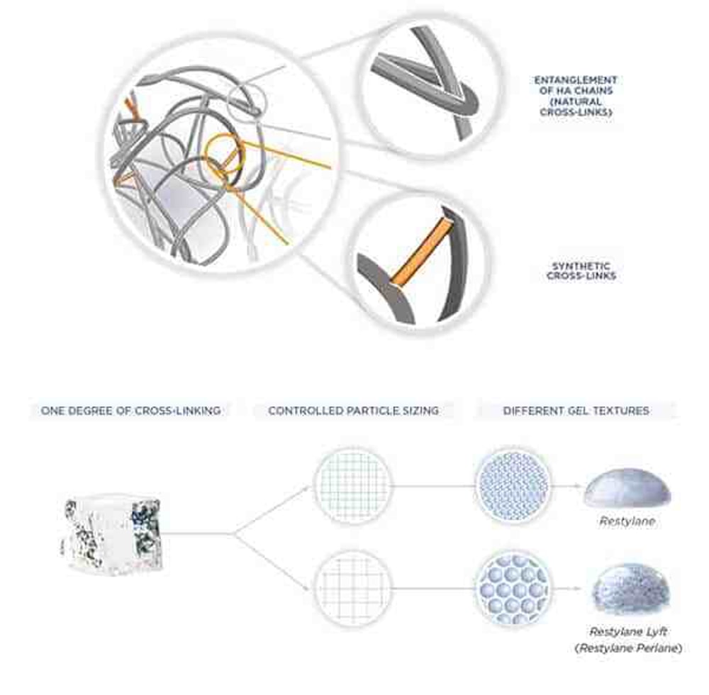 Restylane technology