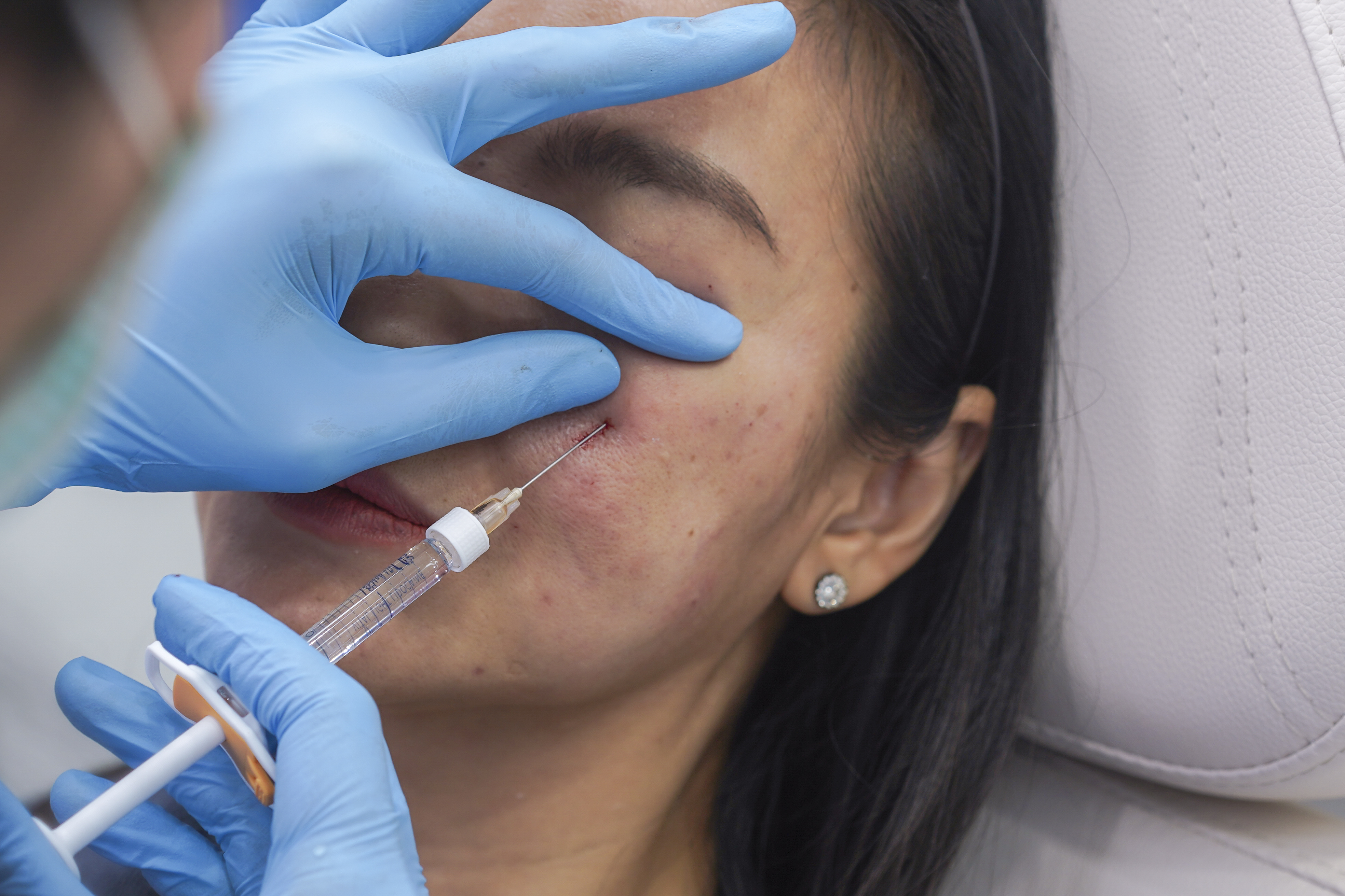 Skin Radiance Injection