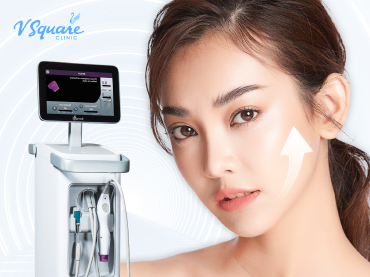 Thermage flx-370x277