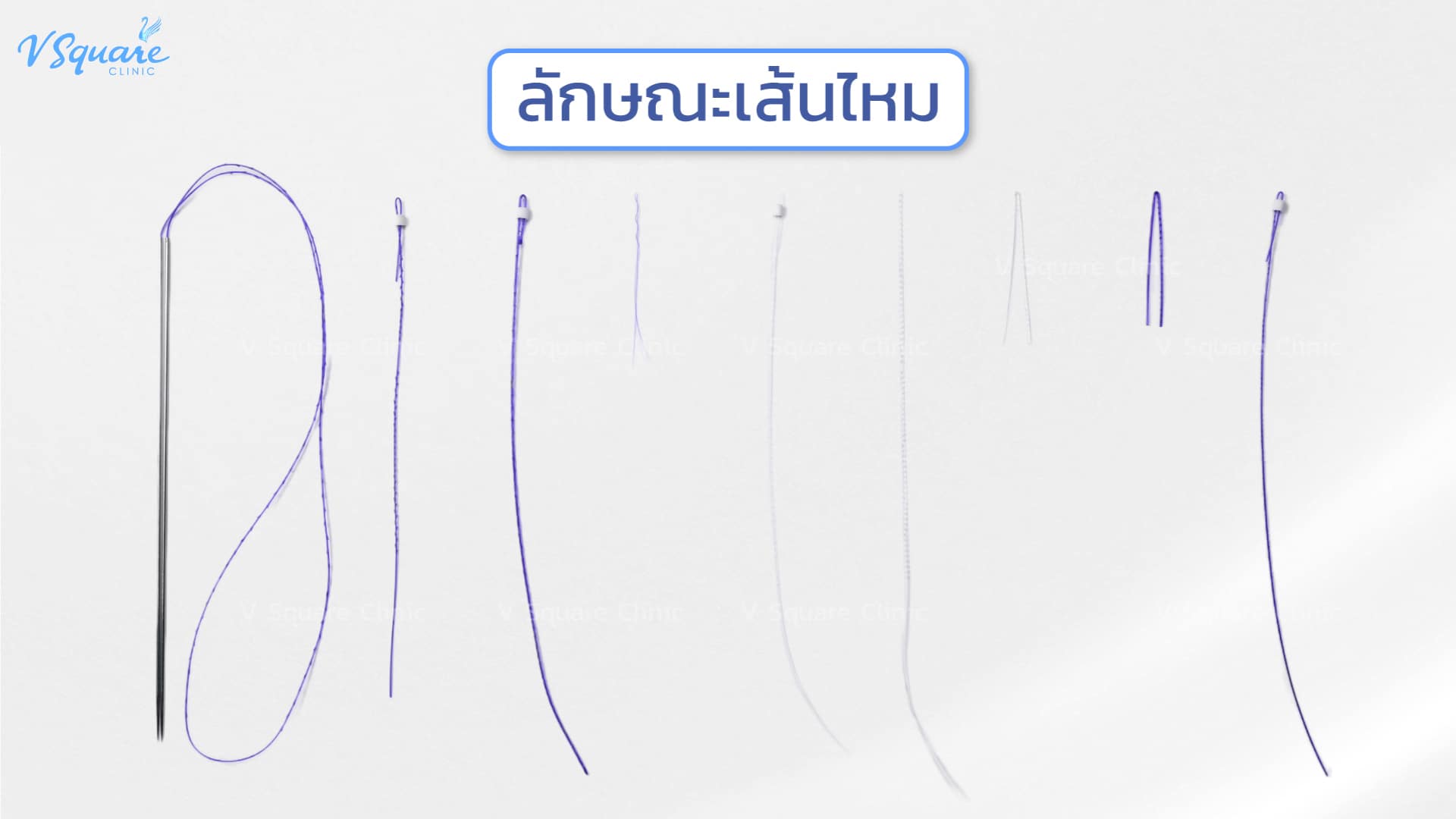 Thread Types Appearance