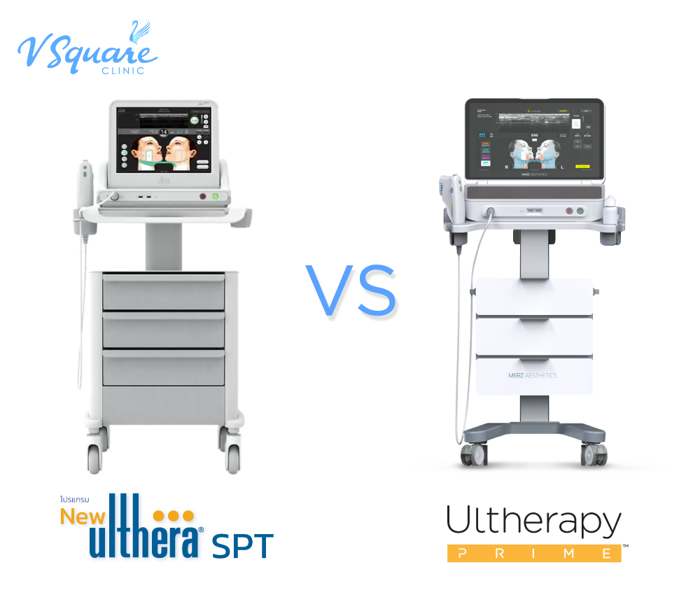 Ulthera SPT vs Ulthera Prime