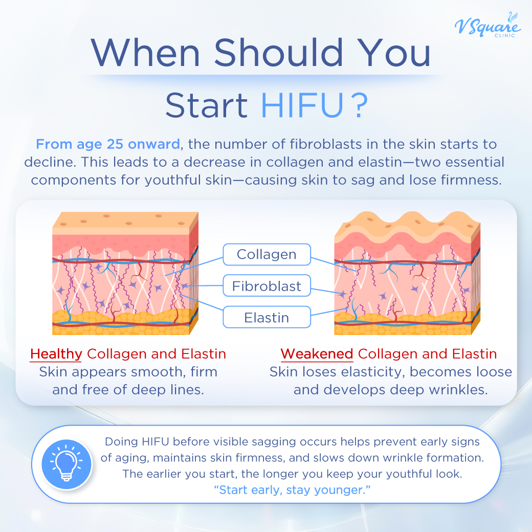 What age can you start HIFU_