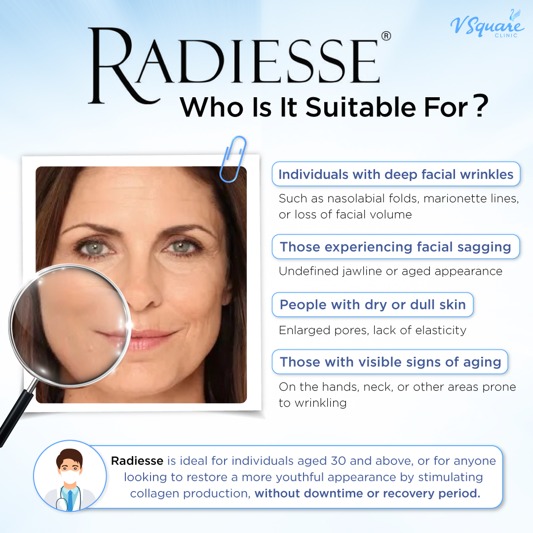 Who is Radiesse Filler suitable for