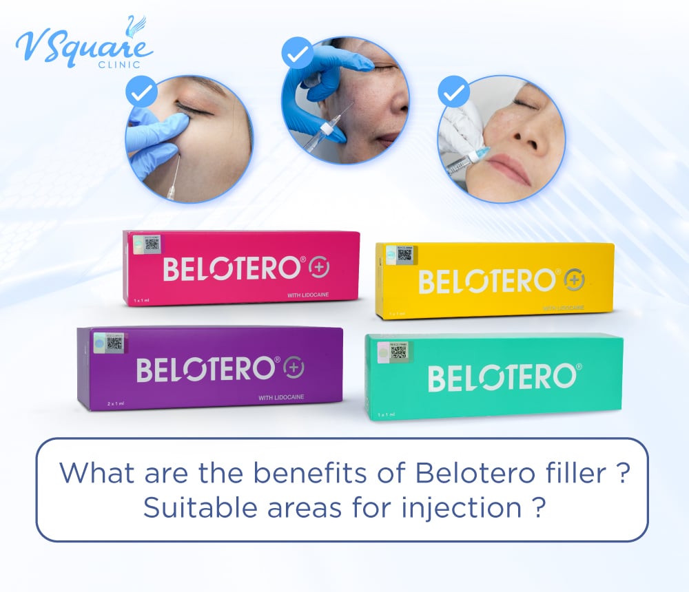 Belotero Filler