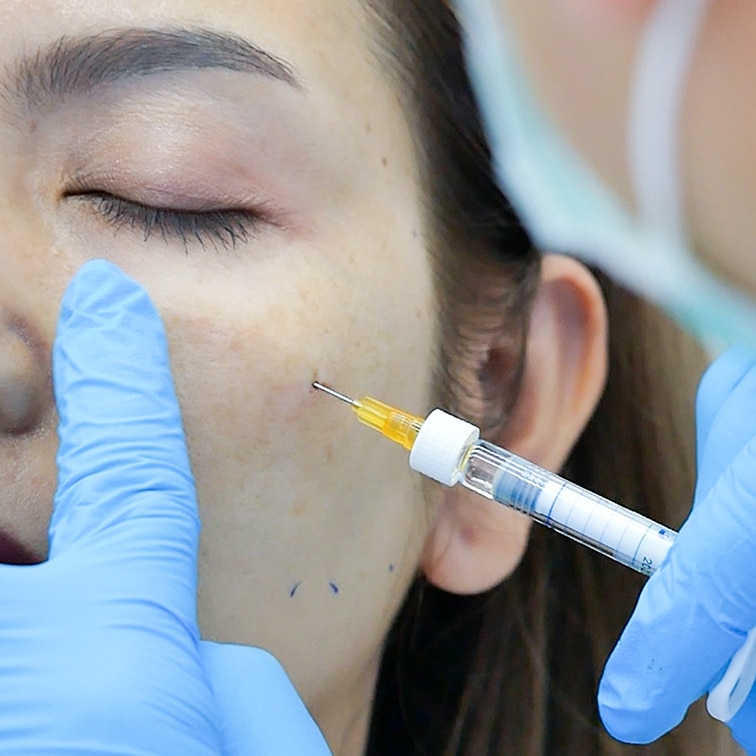 Filler injection by an experienced doctor