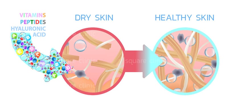 How Vitamin C injection improves skin tone