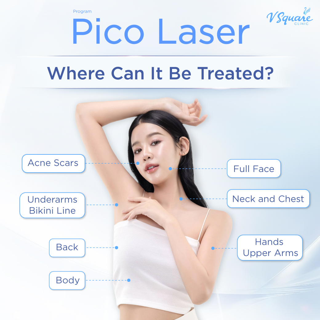 Pico Laser treatment area