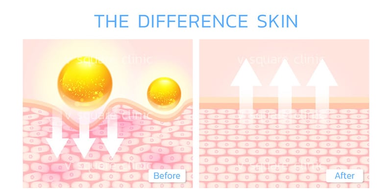 Skin glow from vitamin injection