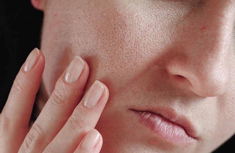 What causes dull or damaged skin