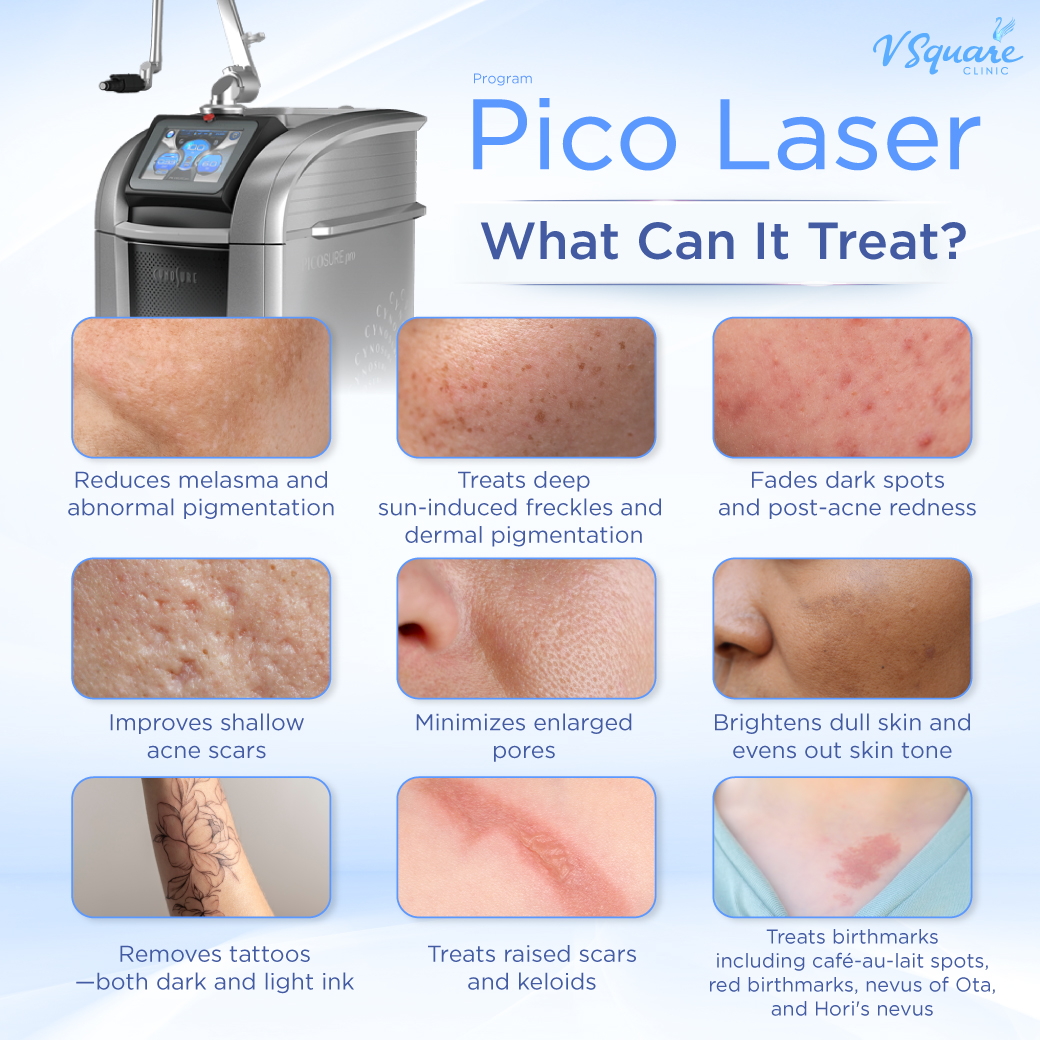 What does a pico laser treat