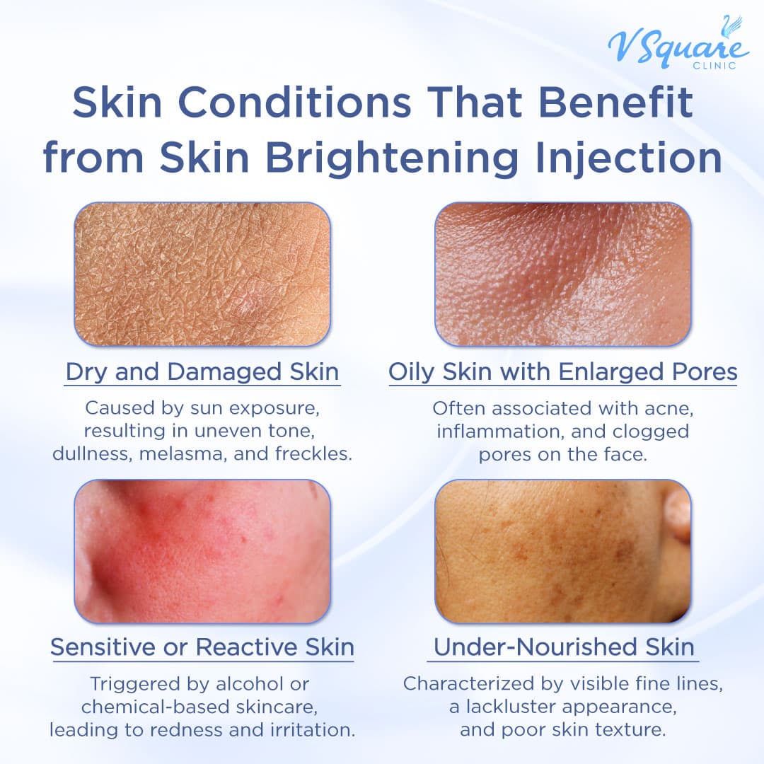 Who is suitable for Skin Brightening Injection