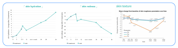 Belotero Revive result