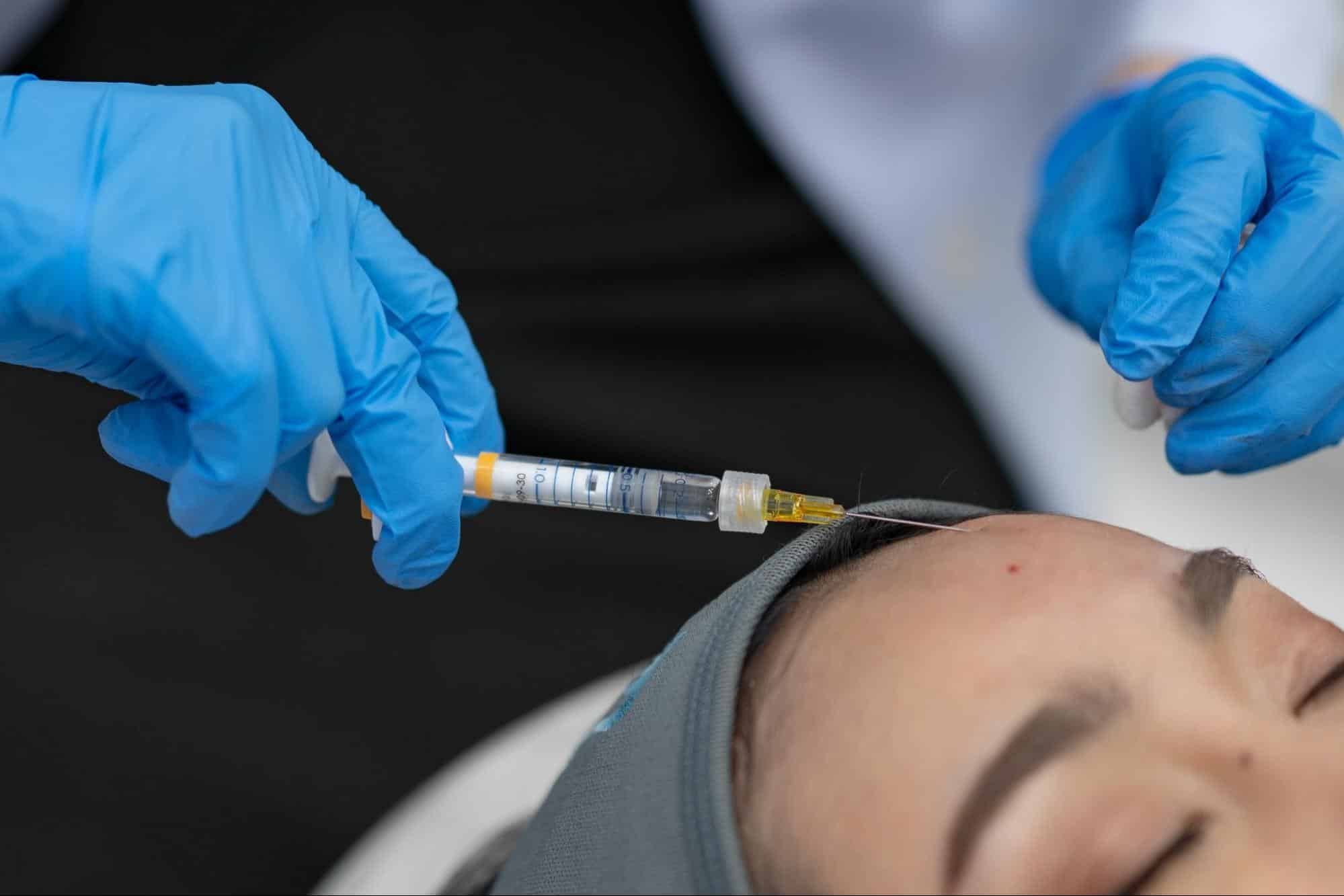 Forehead Filler vs Implants — Which Is the Better Choice