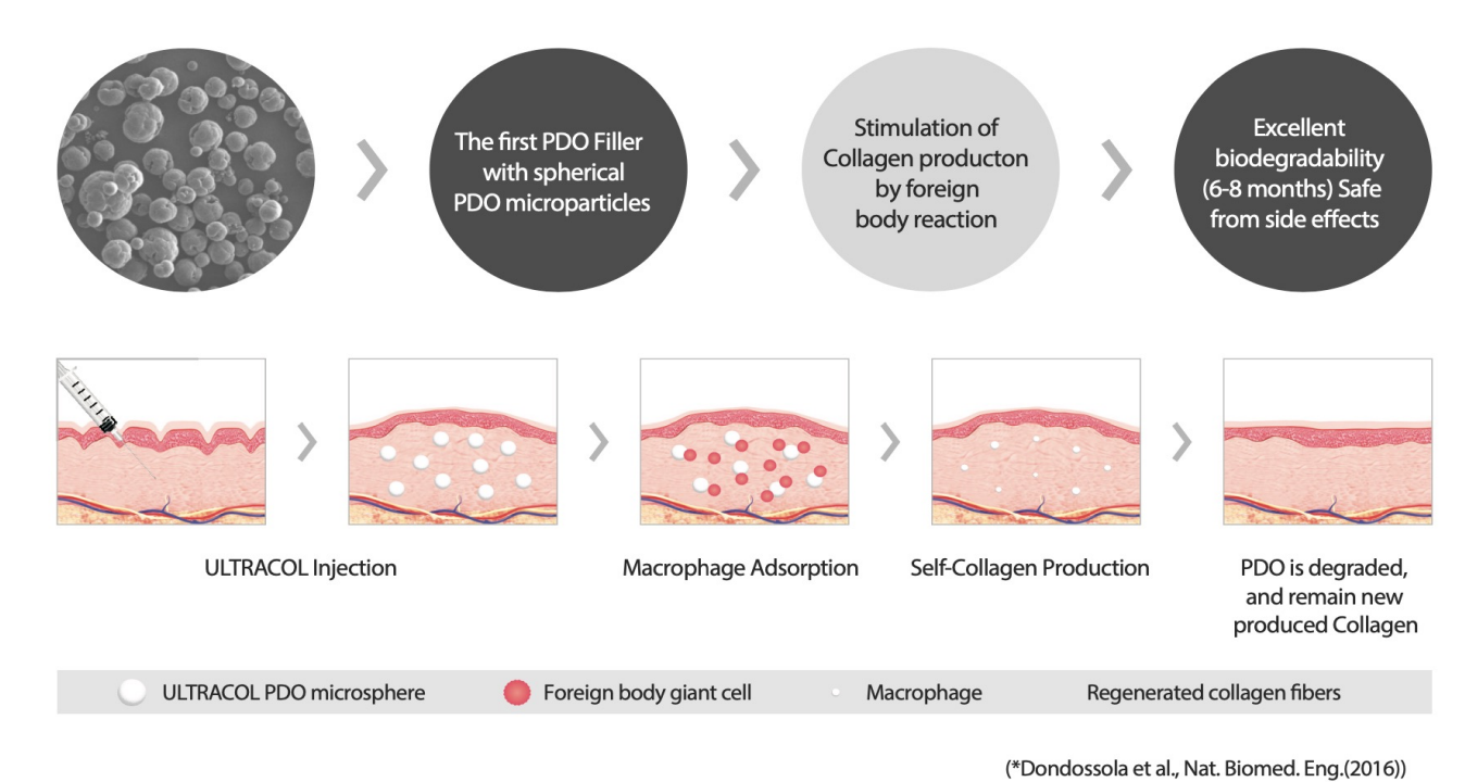 How Ultracol works