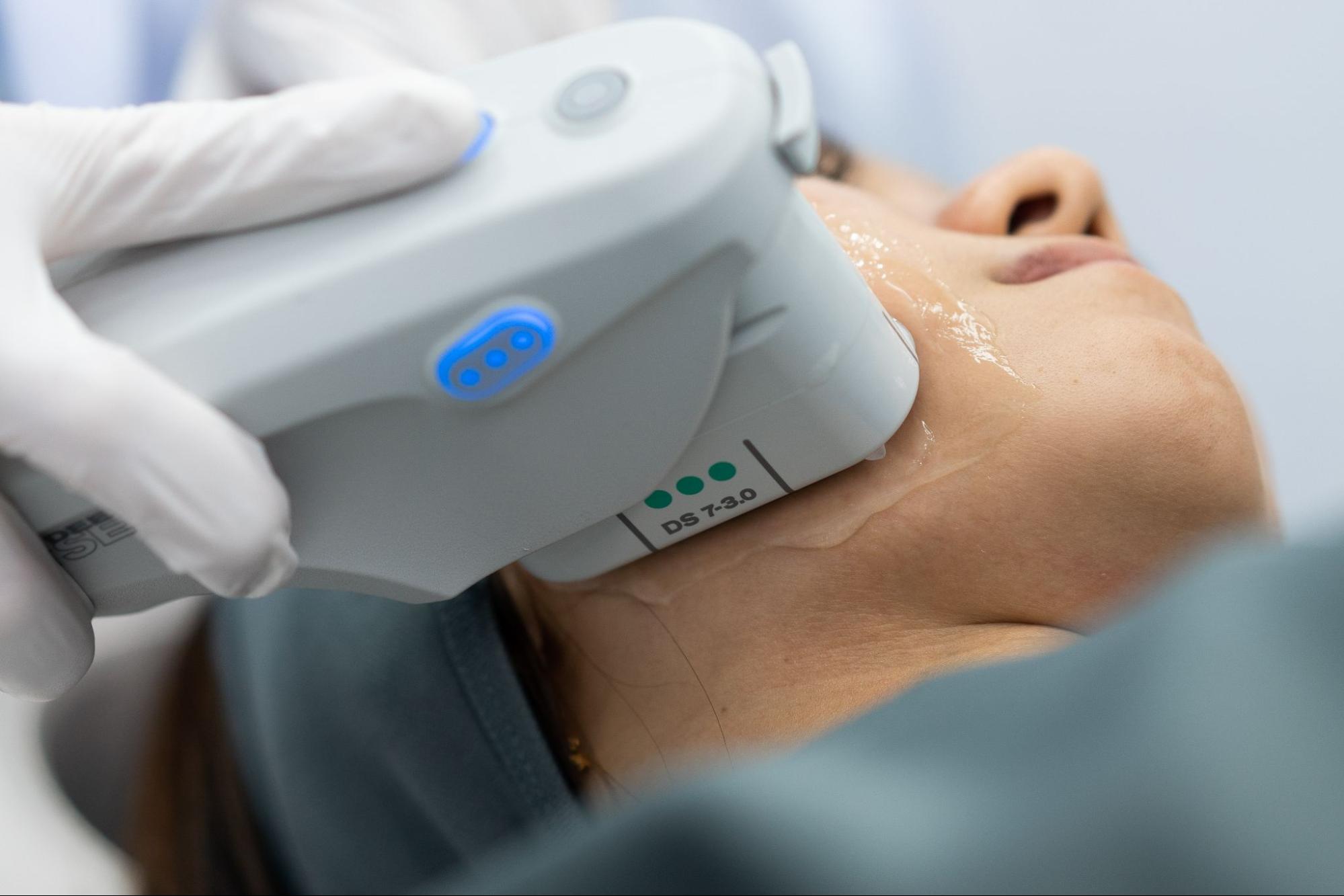 Ulthera SPT facial skin lifting