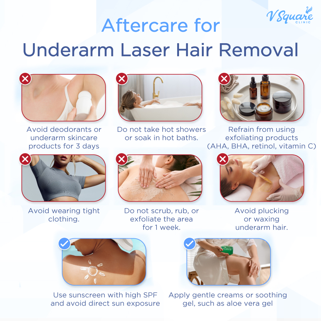 After underarm laser hair removal