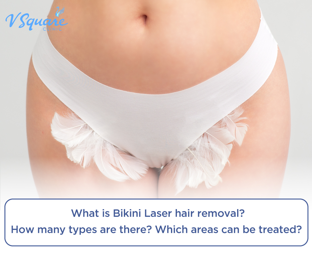 Bikini Laser hair removal