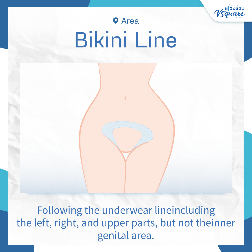 Bikini Laser