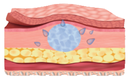 Biobalance Technology