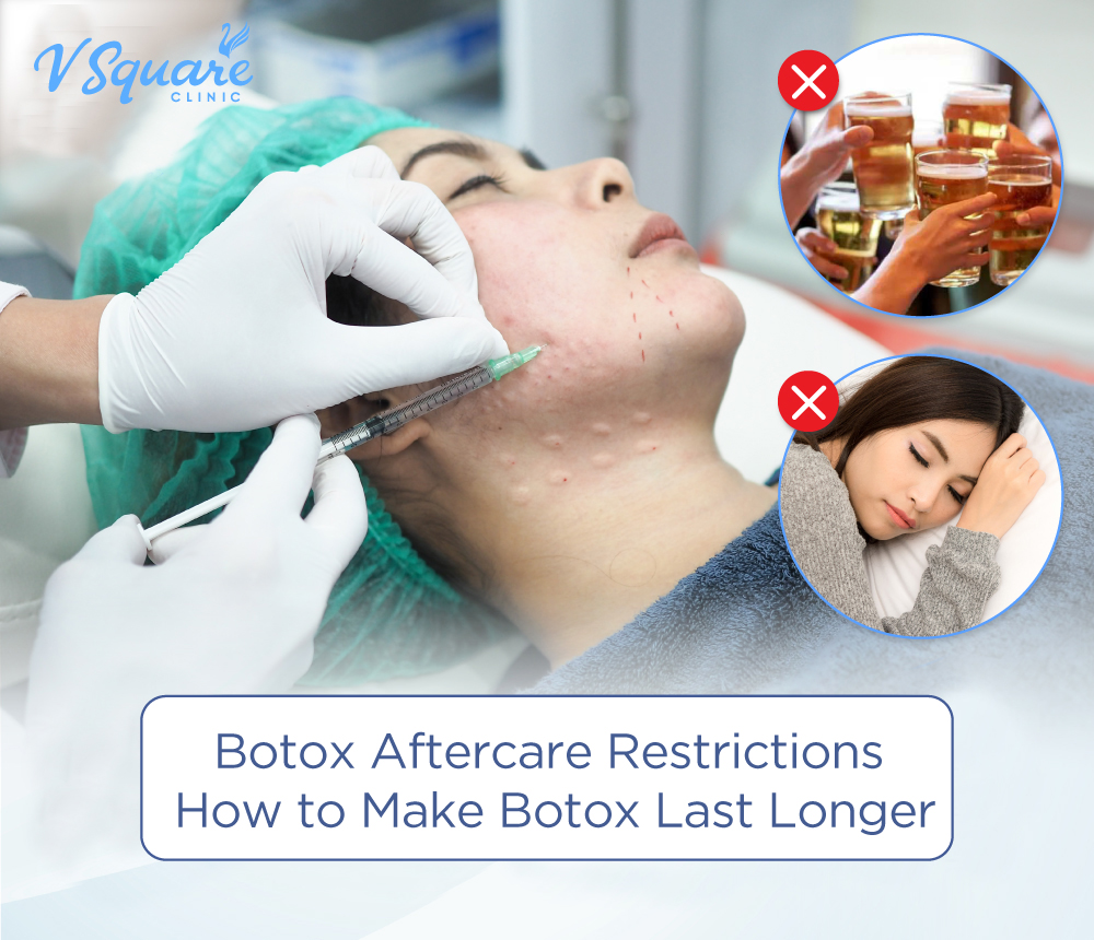 Botox Aftercare Restrictions
