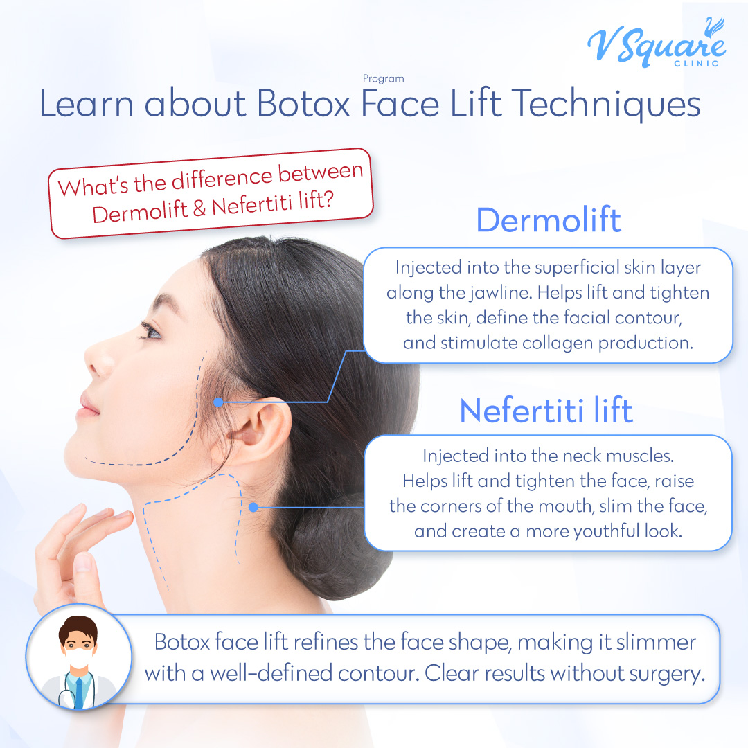 Botox facial lifting technique