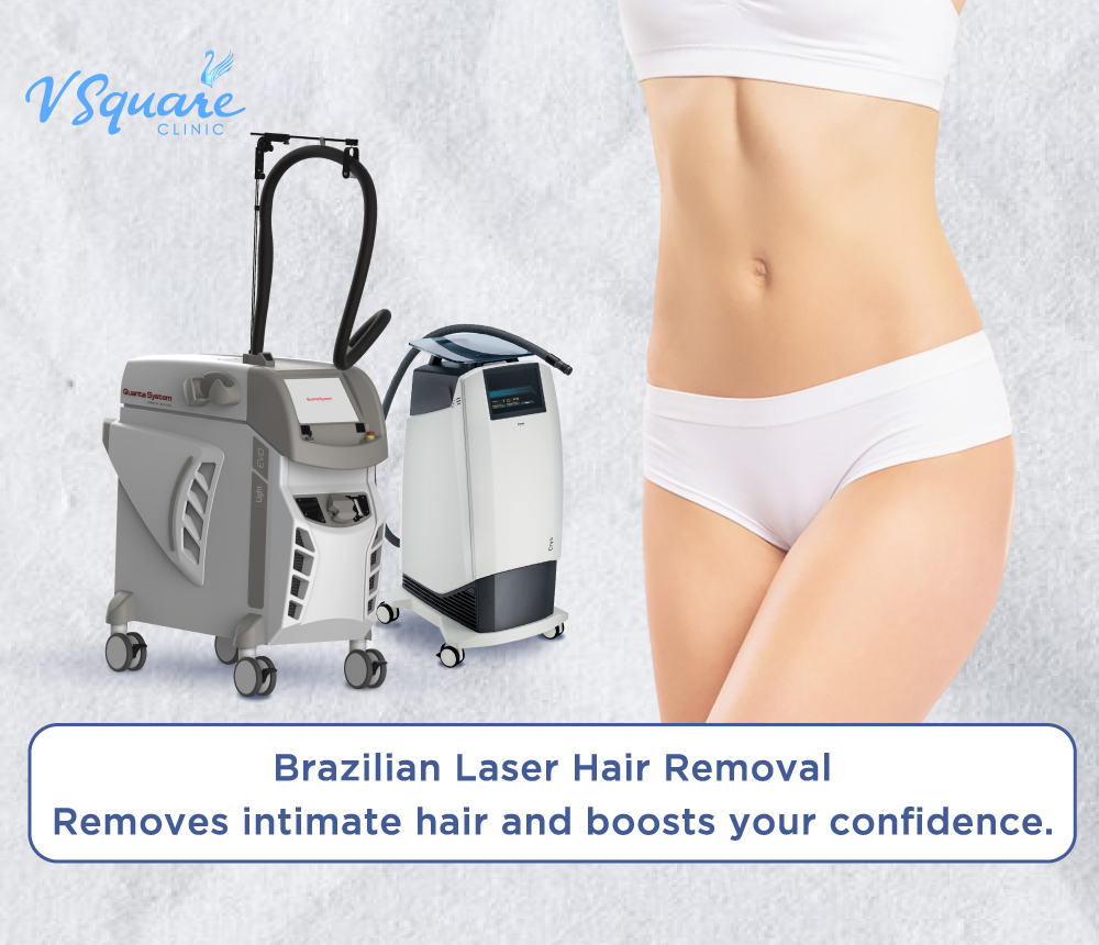 Brazilian Laser Hair Removal