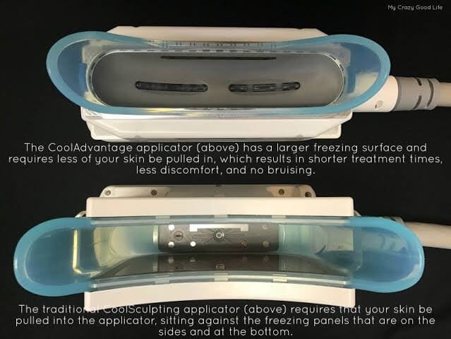 CoolSculpting applicator comparison