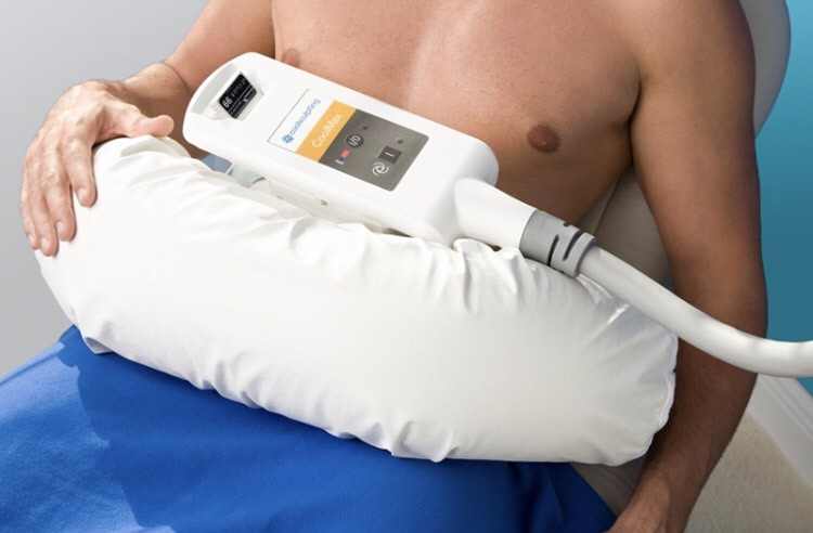 Each CoolSculpting session reduces fat