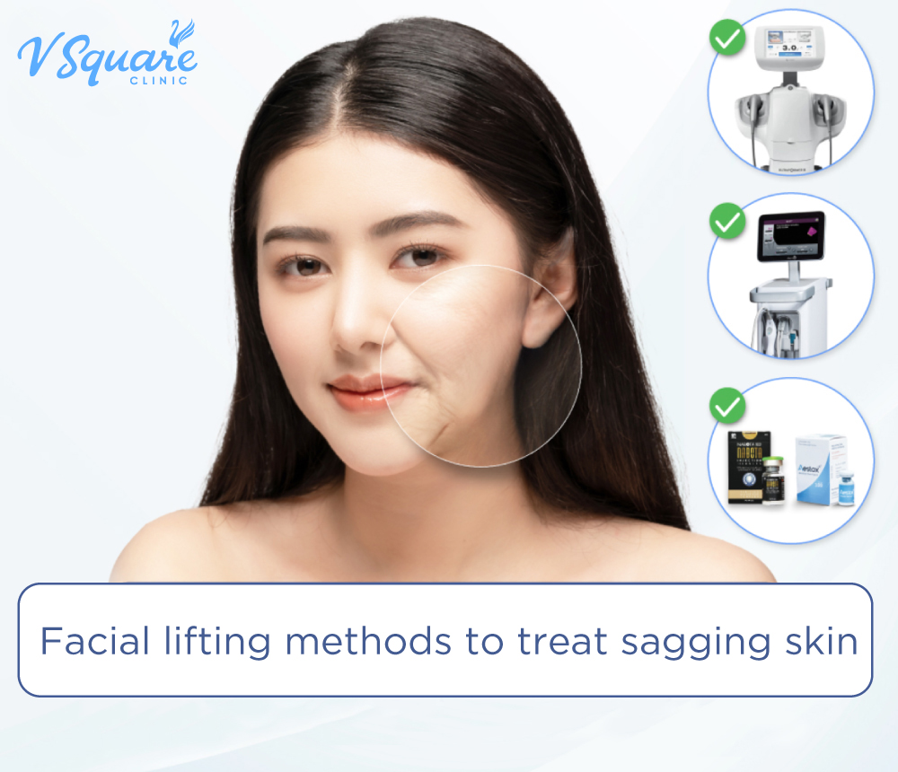 Facial lifting