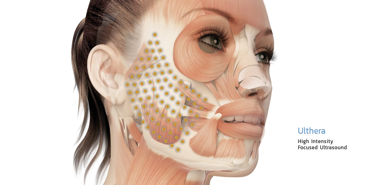 High Intensity Focus Ultrasound