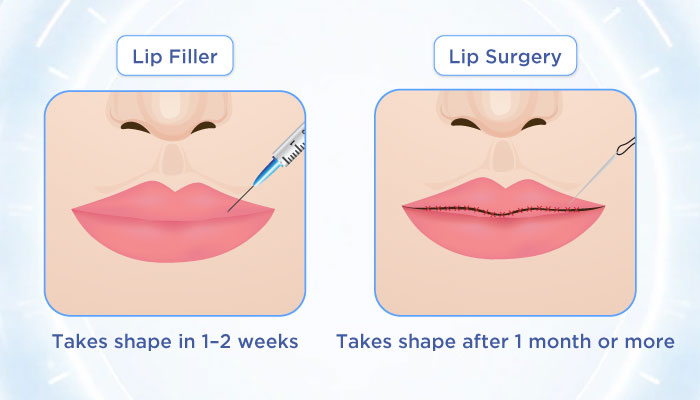 How Many Months Until Lips Settle