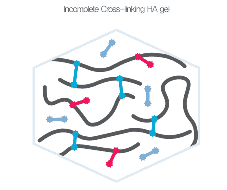 How e.p.t.q. filler works