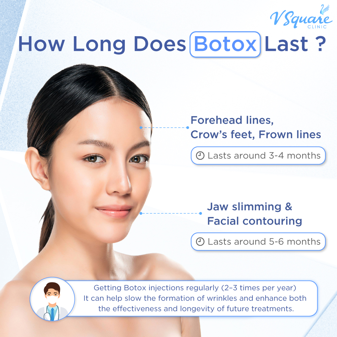 How long do Botox wrinkle reduction results last