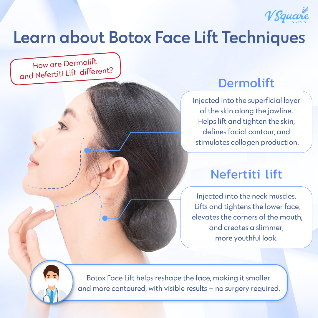 Male Jawline Botox Lift