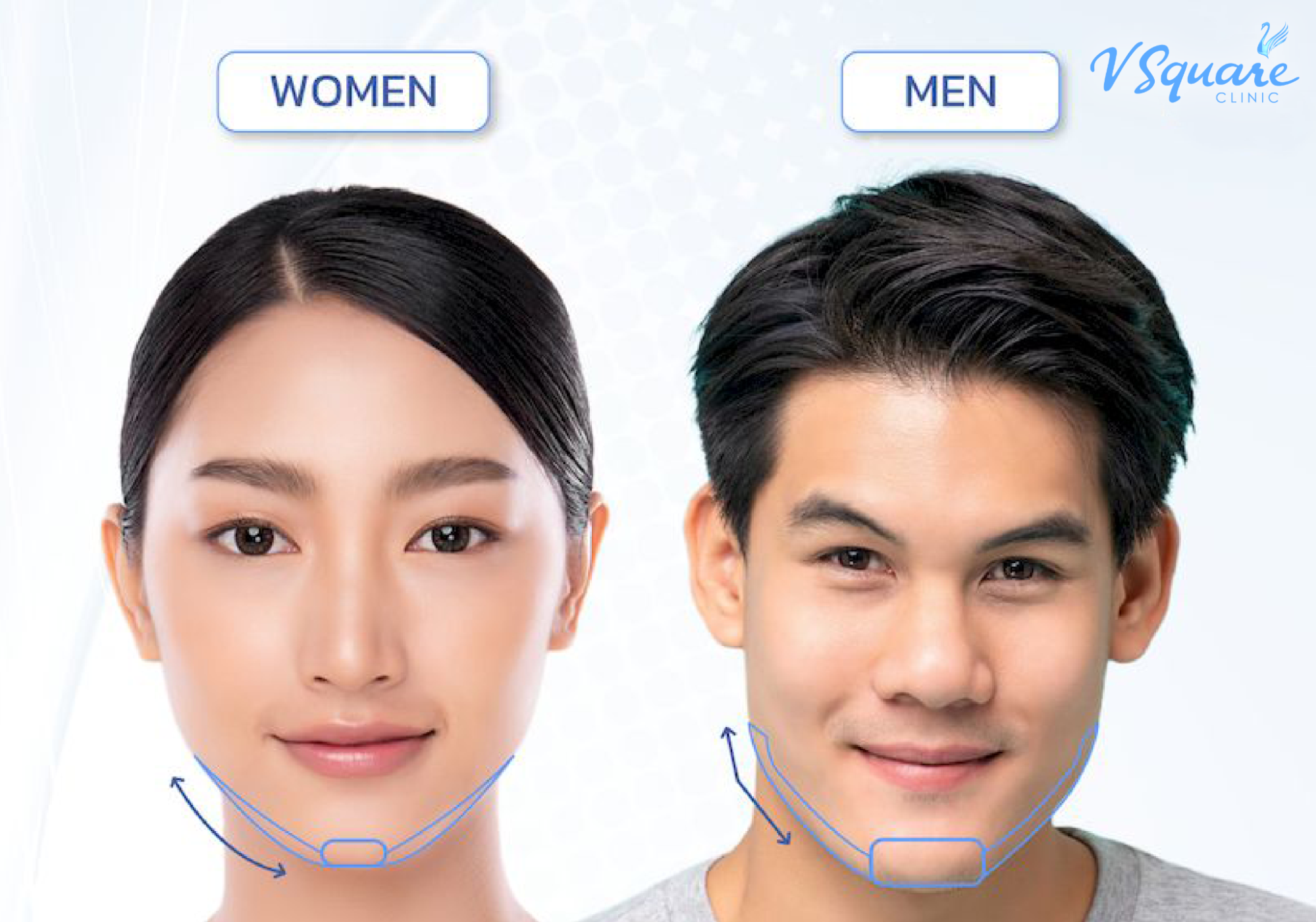 Male vs Female Jawline
