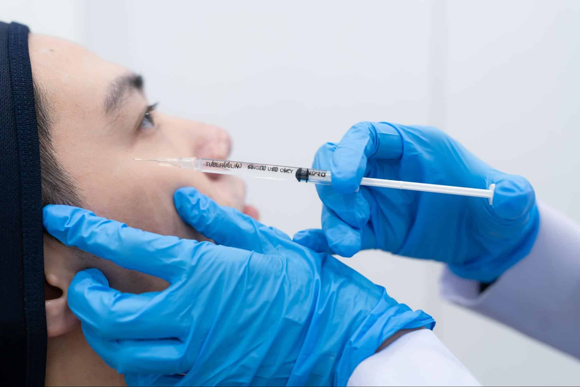 Nabota Botox should be administered by an experienced doctor