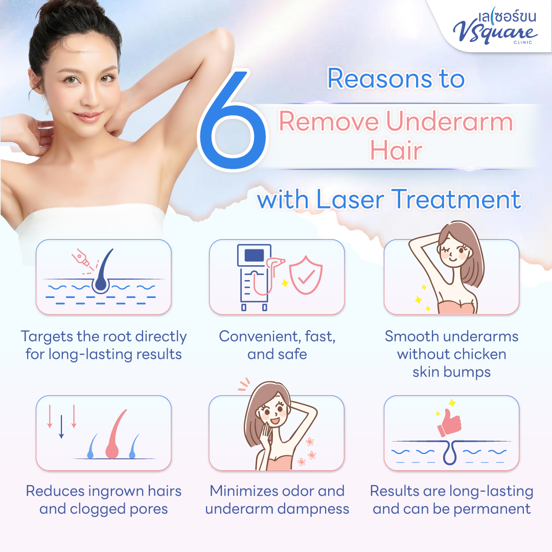 Pros of underarm laser hair removal
